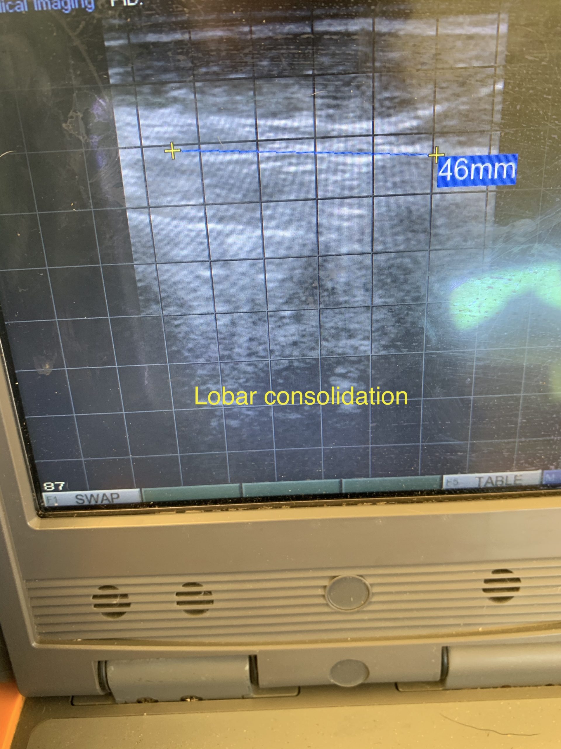 Thoracic ultrasound How do we use it? CalfCare.ca
